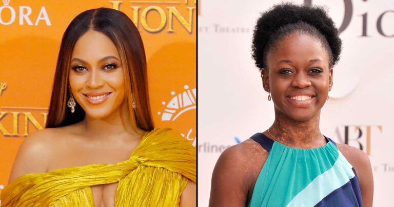 Beyonce Called Ballerina Michaela DePrince a 'Creature From Another Planet'