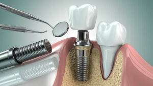 DentalSense-3